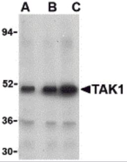 Western blot analysis of TAK1 in Rat thymus cell lysate with TAK1 antibody at (A) 1, (B) 2, and (C) 4 μg/mL.