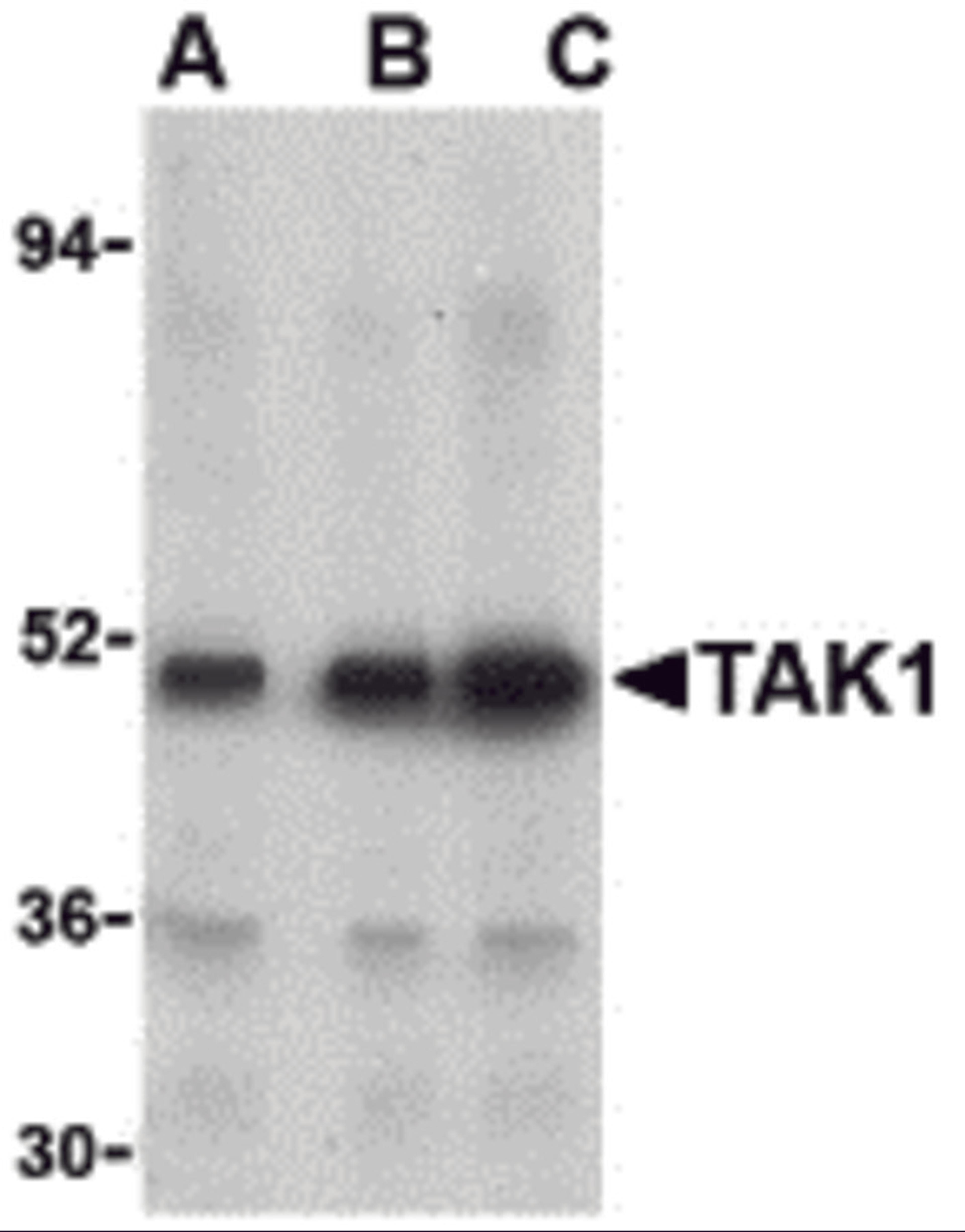 Western blot analysis of TAK1 in Rat thymus cell lysate with TAK1 antibody at (A) 1, (B) 2, and (C) 4 μg/mL.