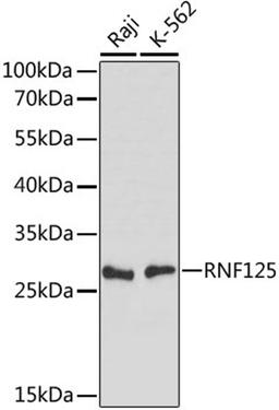 Western blot - RNF125 antibody (A15166)