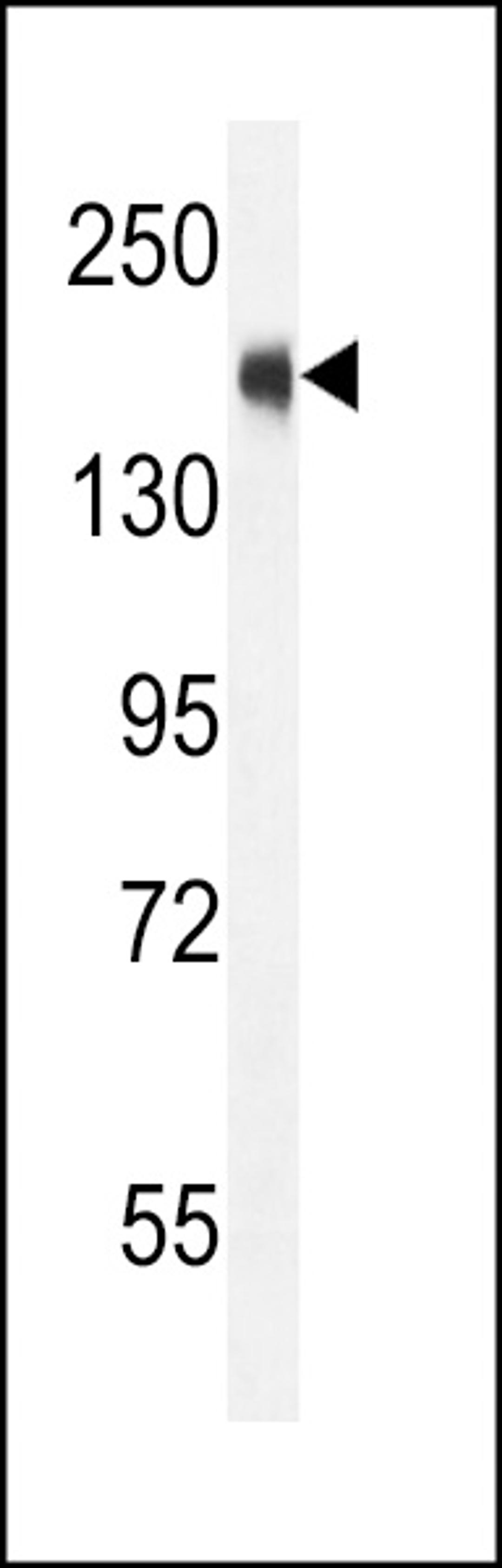 Western blot analysis in CEM cell line lysates (35ug/lane).