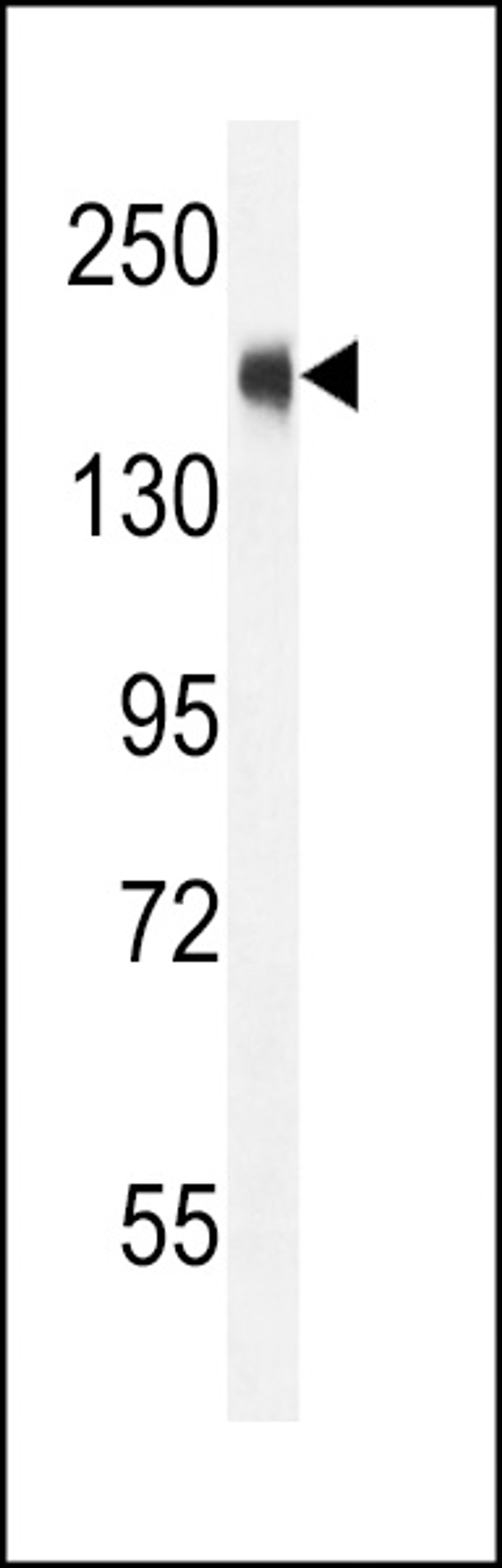 Western blot analysis in CEM cell line lysates (35ug/lane).