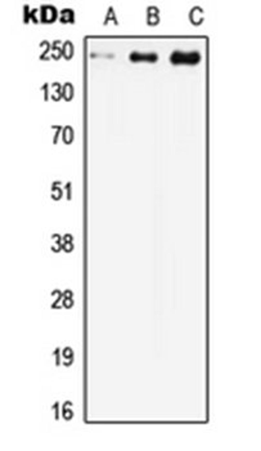 Western blot analysis of HEK293T (Lane 1), Raw264.7 (Lane 2), H9C2 (Lane 3) whole cell lysates using CACNA1C antibody