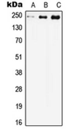 Western blot analysis of HEK293T (Lane 1), Raw264.7 (Lane 2), H9C2 (Lane 3) whole cell lysates using CACNA1C antibody