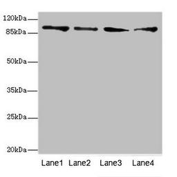Western blot. All lanes: TNNI3K antibody at 4.77ug/ml. Lane 1: Hela whole cell lysate. Lane 2: Mouse heart tissue. Lane 3: HepG2 whole cell lysate. Lane 4: Jurkat whole cell lysate. Secondary. Goat polyclonal to rabbit IgG at 1/10000 dilution. Predicted band size: 93, 105, 78, 95 kDa. Observed band size: 93 kDa. 