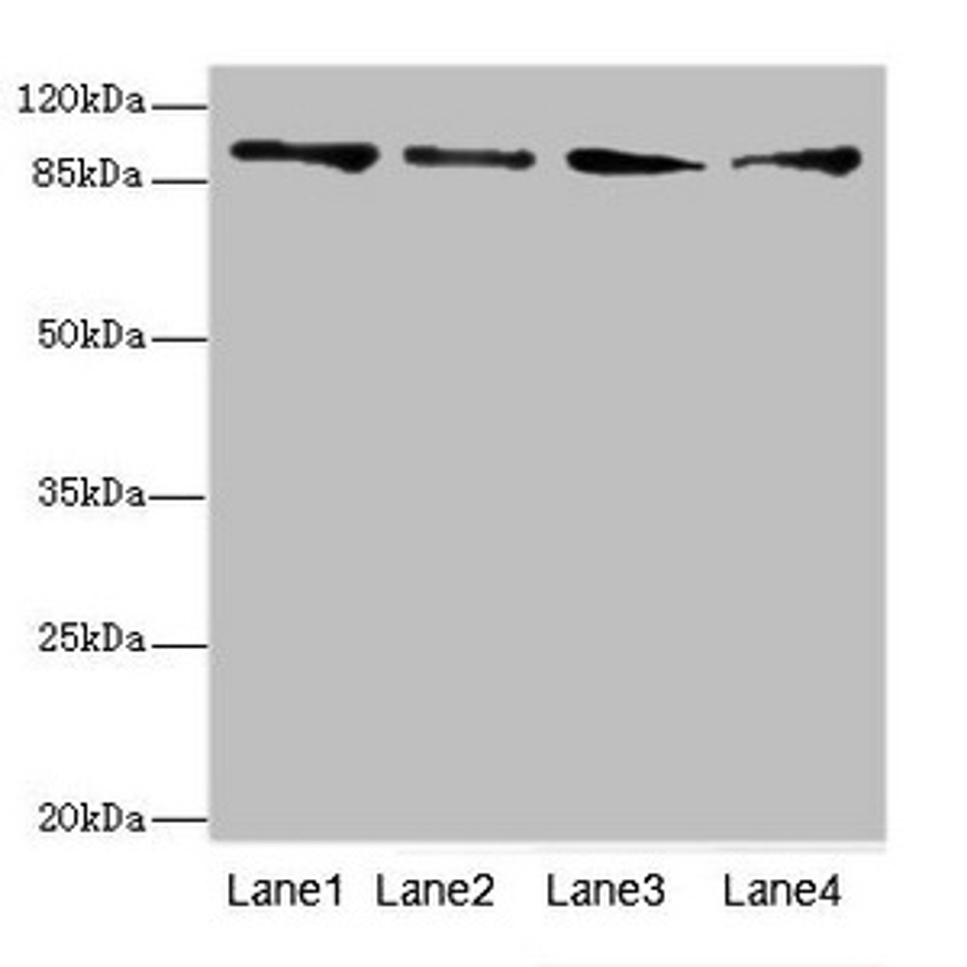 Western blot. All lanes: TNNI3K antibody at 4.77ug/ml. Lane 1: Hela whole cell lysate. Lane 2: Mouse heart tissue. Lane 3: HepG2 whole cell lysate. Lane 4: Jurkat whole cell lysate. Secondary. Goat polyclonal to rabbit IgG at 1/10000 dilution. Predicted band size: 93, 105, 78, 95 kDa. Observed band size: 93 kDa. 