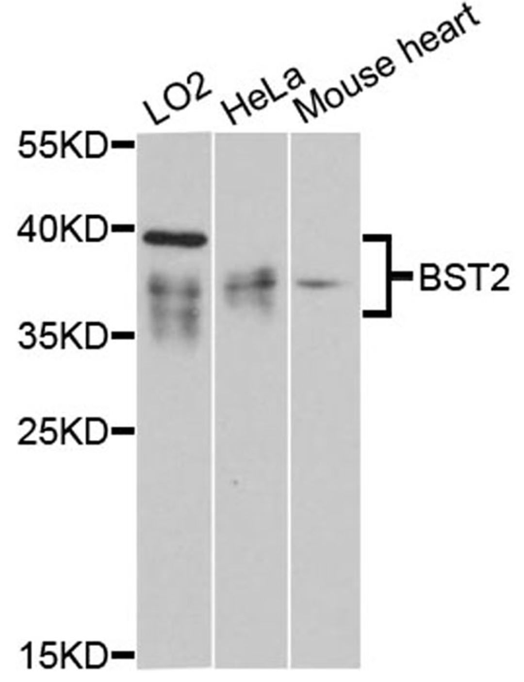 Western blot - BST2 antibody (A12315)