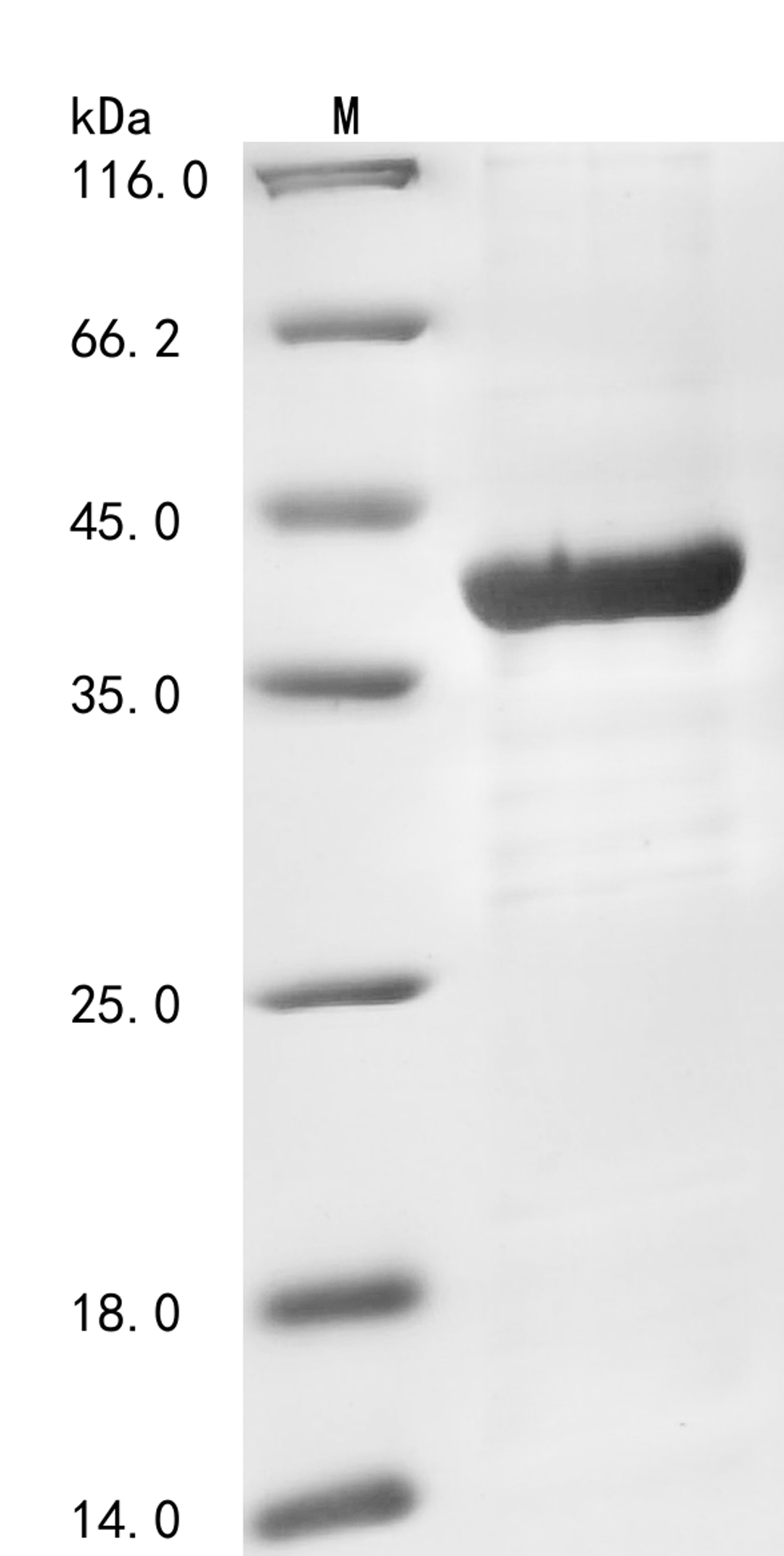 (Tris-Glycine gel) Discontinuous SDS-PAGE (reduced) with 5% enrichment gel and 15% separation gel.