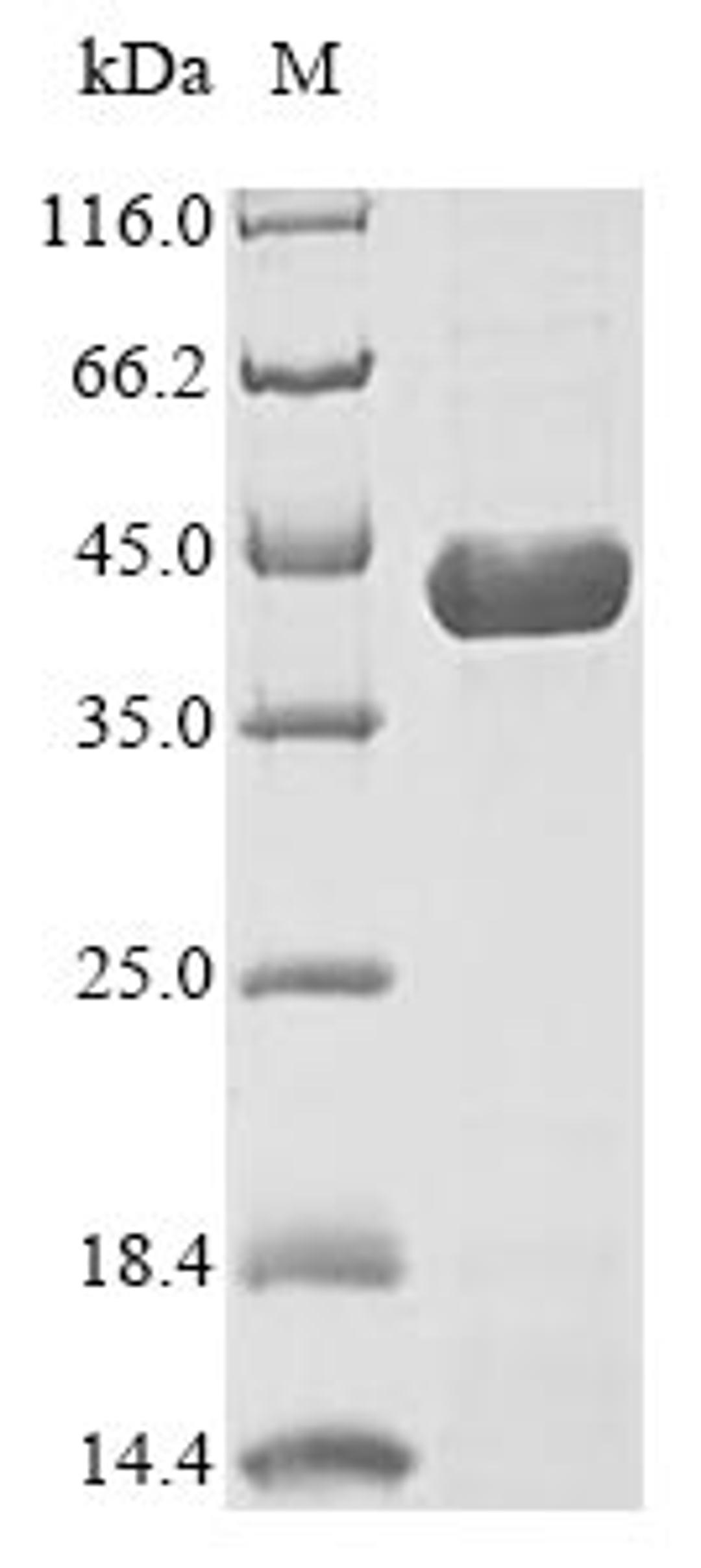 (Tris-Glycine gel) Discontinuous SDS-PAGE (reduced) with 5% enrichment gel and 15% separation gel.