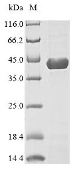(Tris-Glycine gel) Discontinuous SDS-PAGE (reduced) with 5% enrichment gel and 15% separation gel.