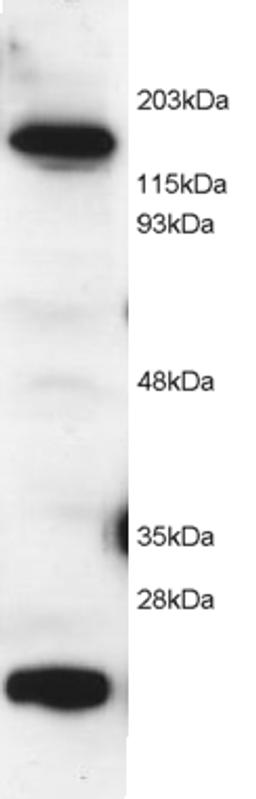 45-914 (2ug/ml) staining of Hela lysate (RIPA buffer, 1.4E5 cells per lane). Detected by chemiluminescence.