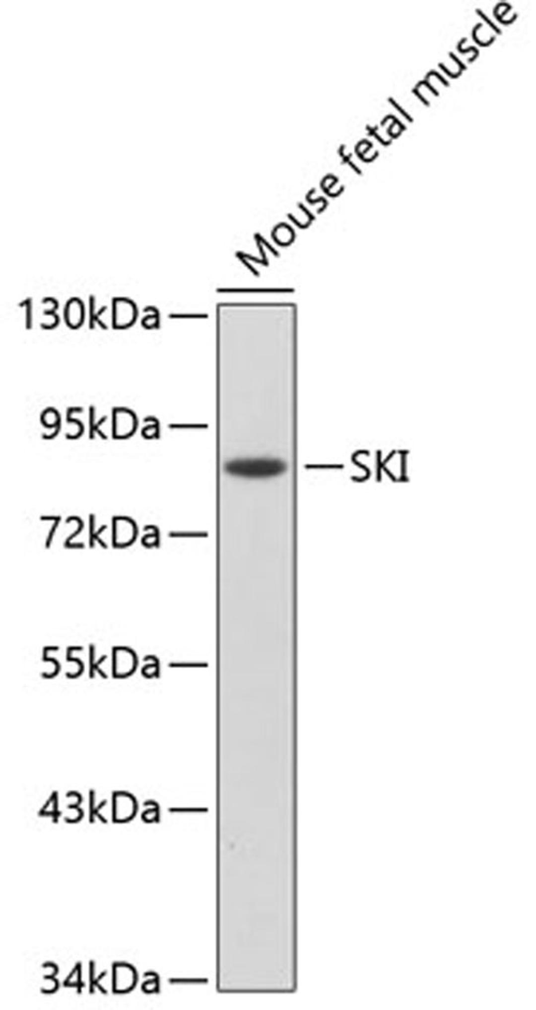 Western blot - SKI antibody (A2879)