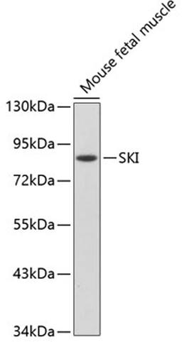 Western blot - SKI antibody (A2879)