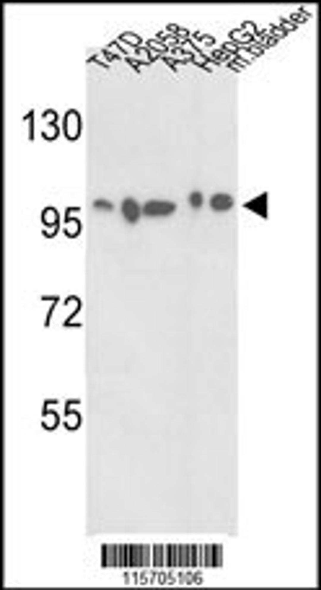 Western blot analysis of ACTN4 Antibody in T47D, A2058, A375, HepG2 cell line and mouse bladder tissue lysates (35ug/lane)