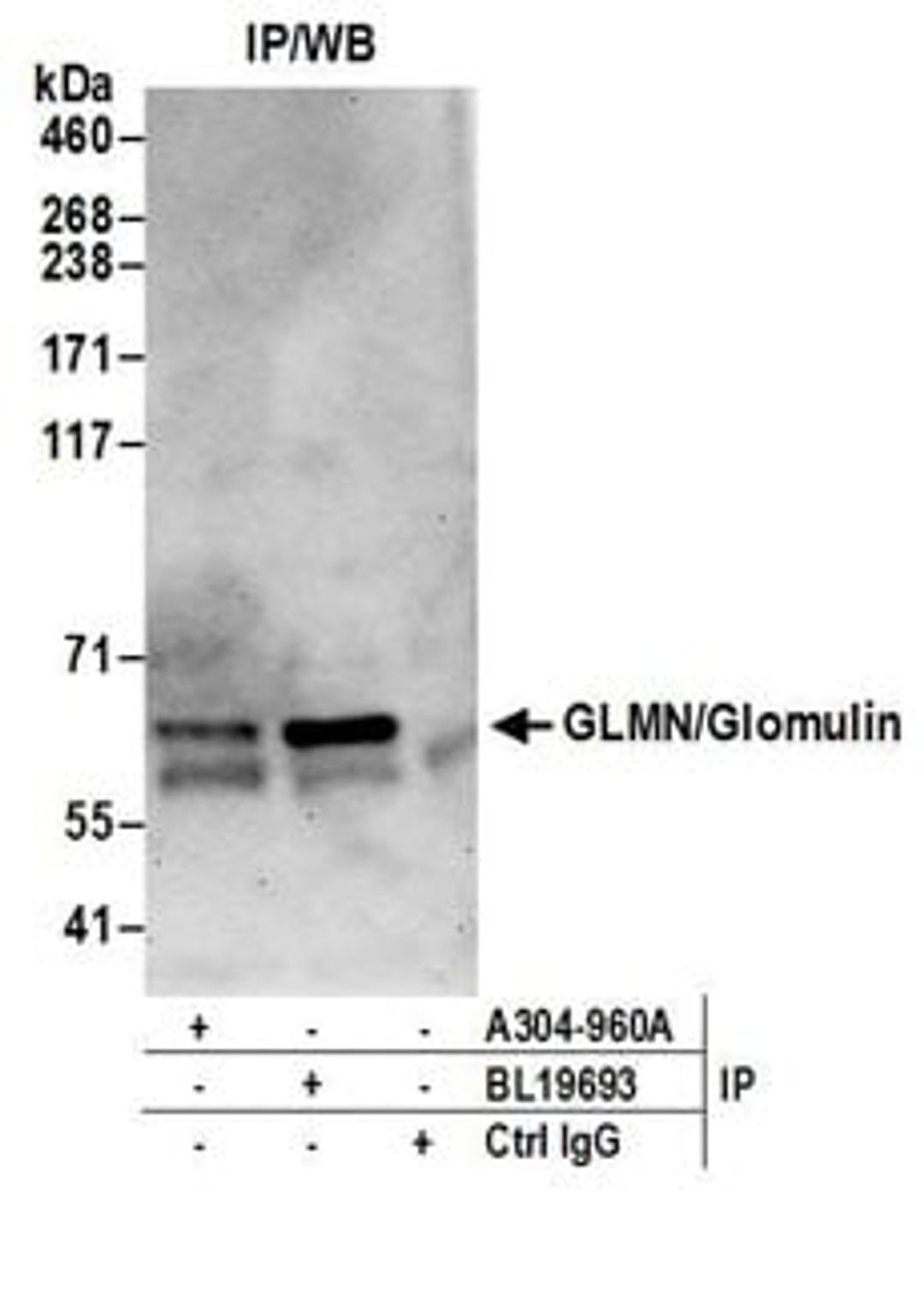 Detection of human GLMN/Glomulin by western blot of immunoprecipitates.