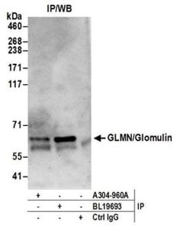 Detection of human GLMN/Glomulin by western blot of immunoprecipitates.