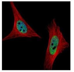 Immunocytochemistry/Immunofluorescence: SNRPA1 Antibody [NBP1-31808] - Paraformaldehyde-fixed HeLa, using SNRPA antibody (Green) at 1:500 dilution. Alpha-tubulin filaments were labeled with an alpha Tubulin antibody (Red) at 1:2000.