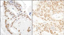 Detection of human and mouse DDX27 by immunohistochemistry.