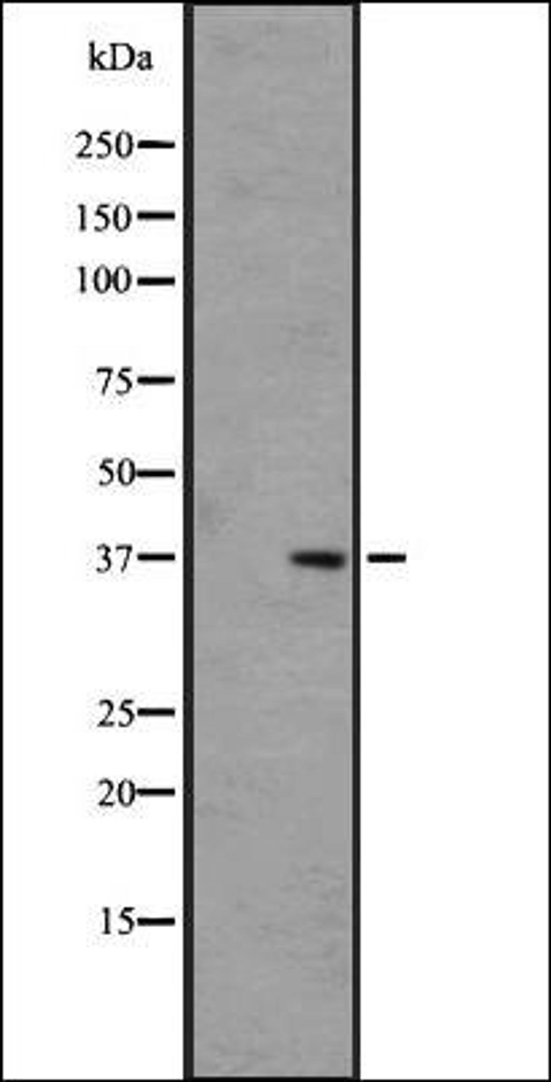 Western blot analysis of COLO205 cell lysate using OR5H6/5H14 antibody