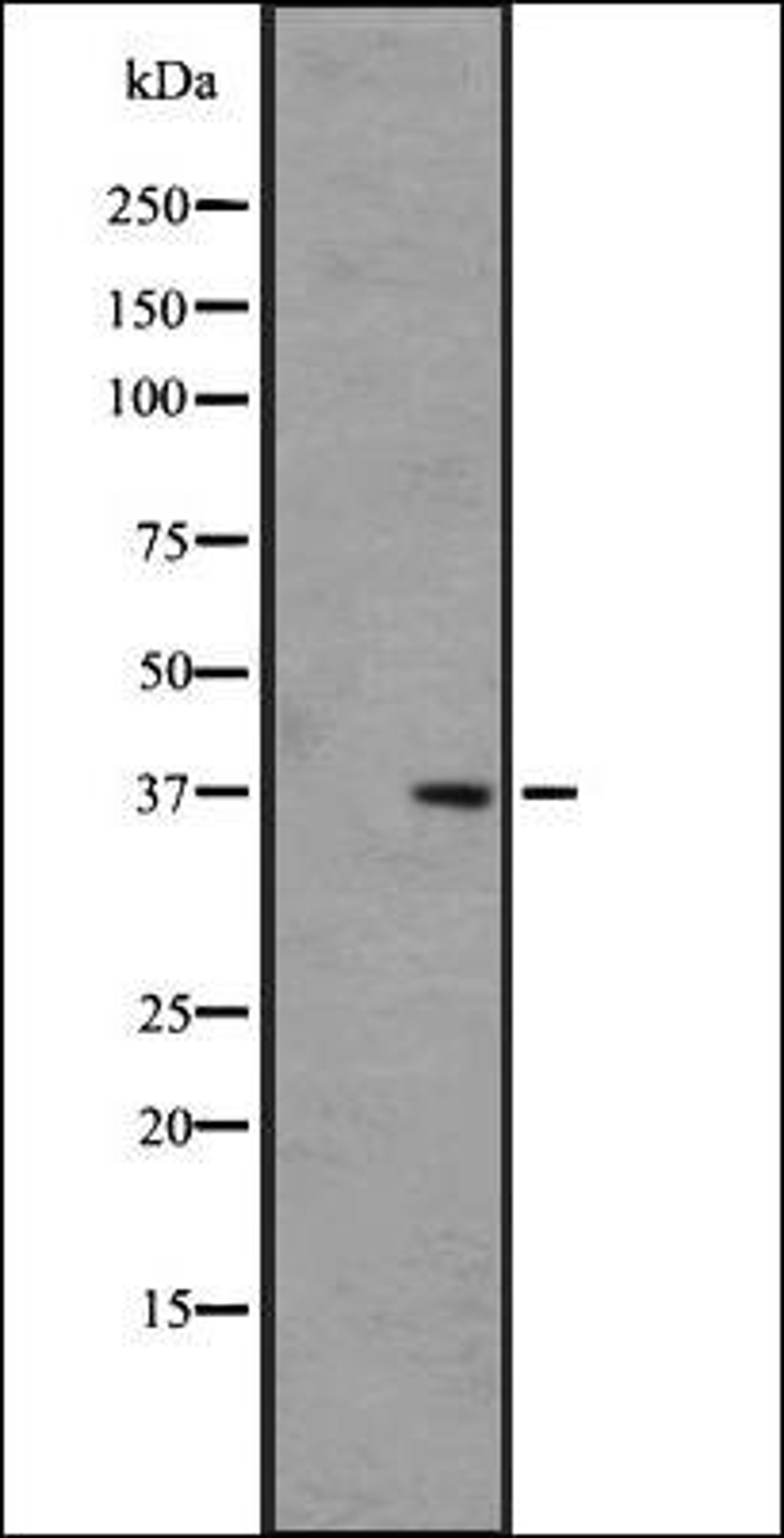 Western blot analysis of COLO205 cell lysate using OR5H6/5H14 antibody