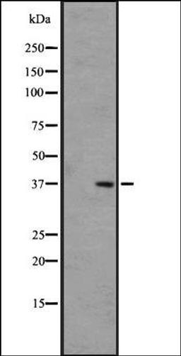 Western blot analysis of COLO205 cell lysate using OR5H6/5H14 antibody