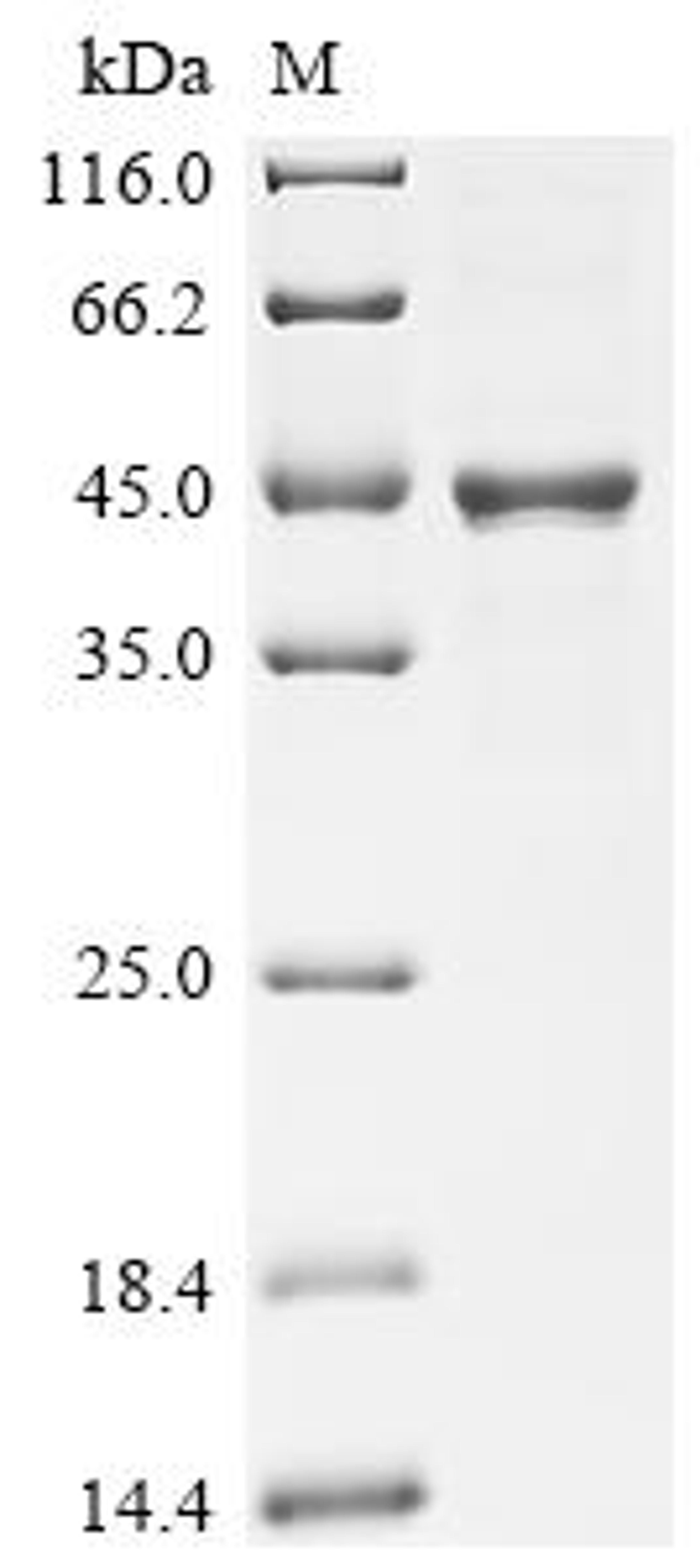 (Tris-Glycine gel) Discontinuous SDS-PAGE (reduced) with 5% enrichment gel and 15% separation gel.