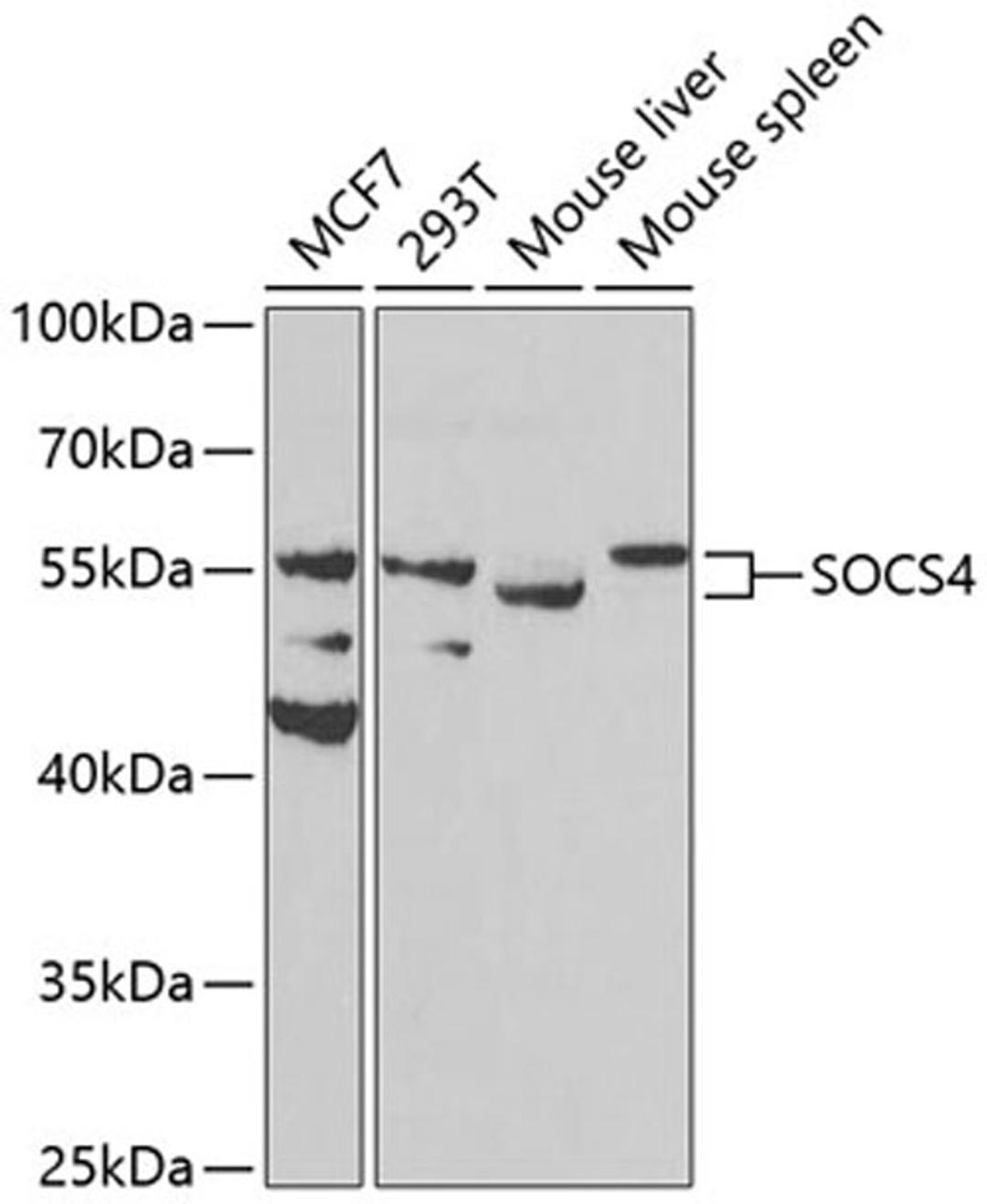 Western blot - SOCS4 antibody (A8003)