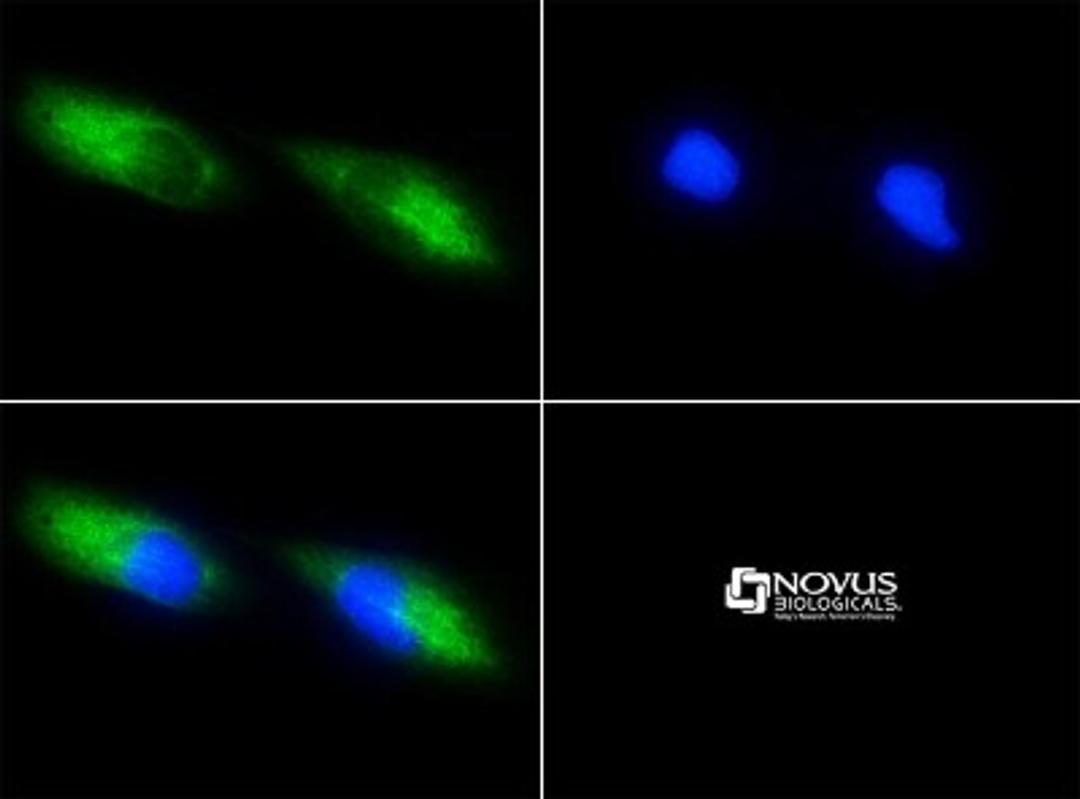 Immunocytochemistry/Immunofluorescence: Survivin Antibody (8E2) [NB500-644] - Survivin 8E2 antibody was tested in HeLa cells with FITC (green). Nuclei were counterstained with DAPI (blue).