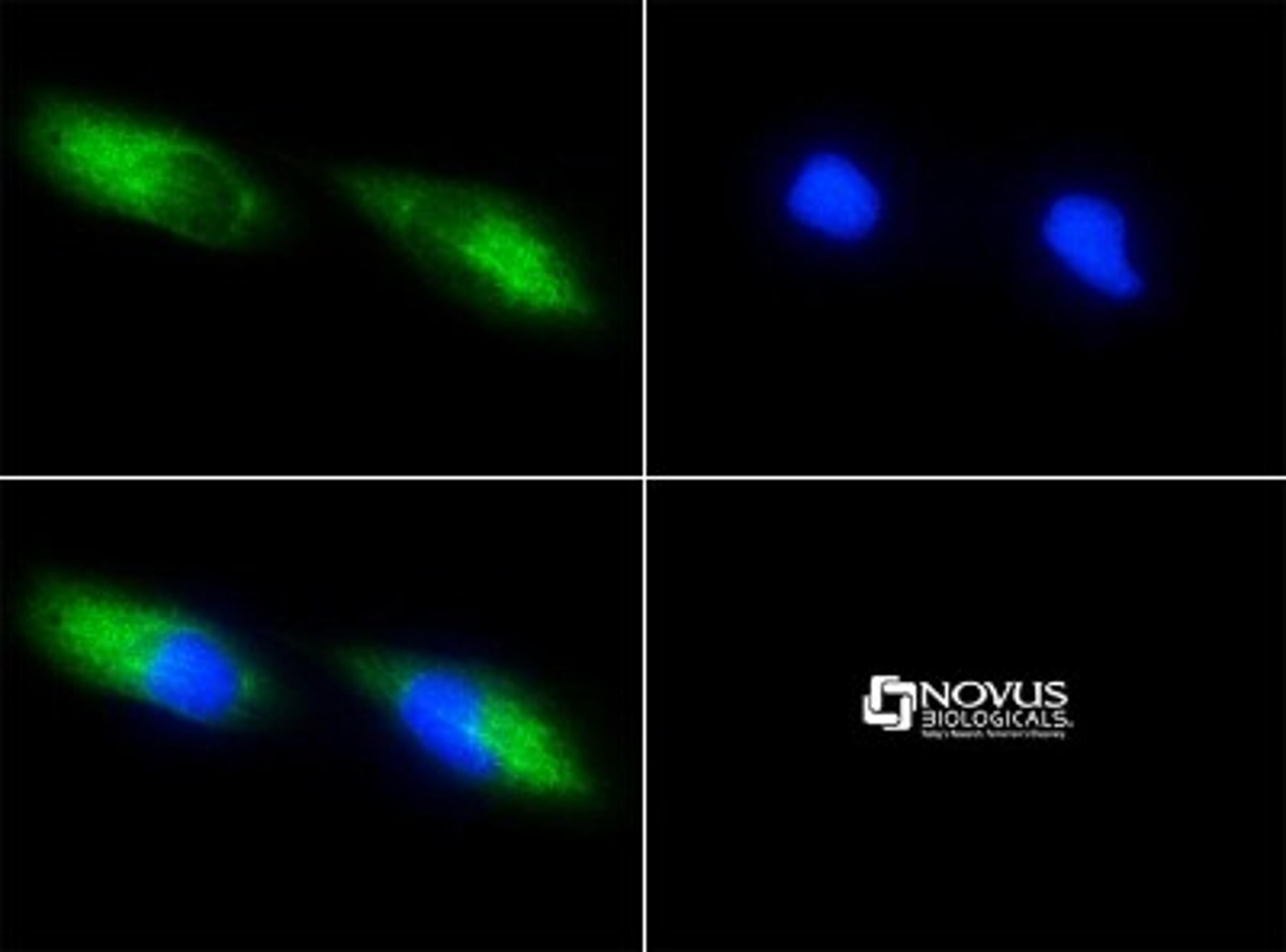 Immunocytochemistry/Immunofluorescence: Survivin Antibody (8E2) [NB500-644] - Survivin 8E2 antibody was tested in HeLa cells with FITC (green). Nuclei were counterstained with DAPI (blue).