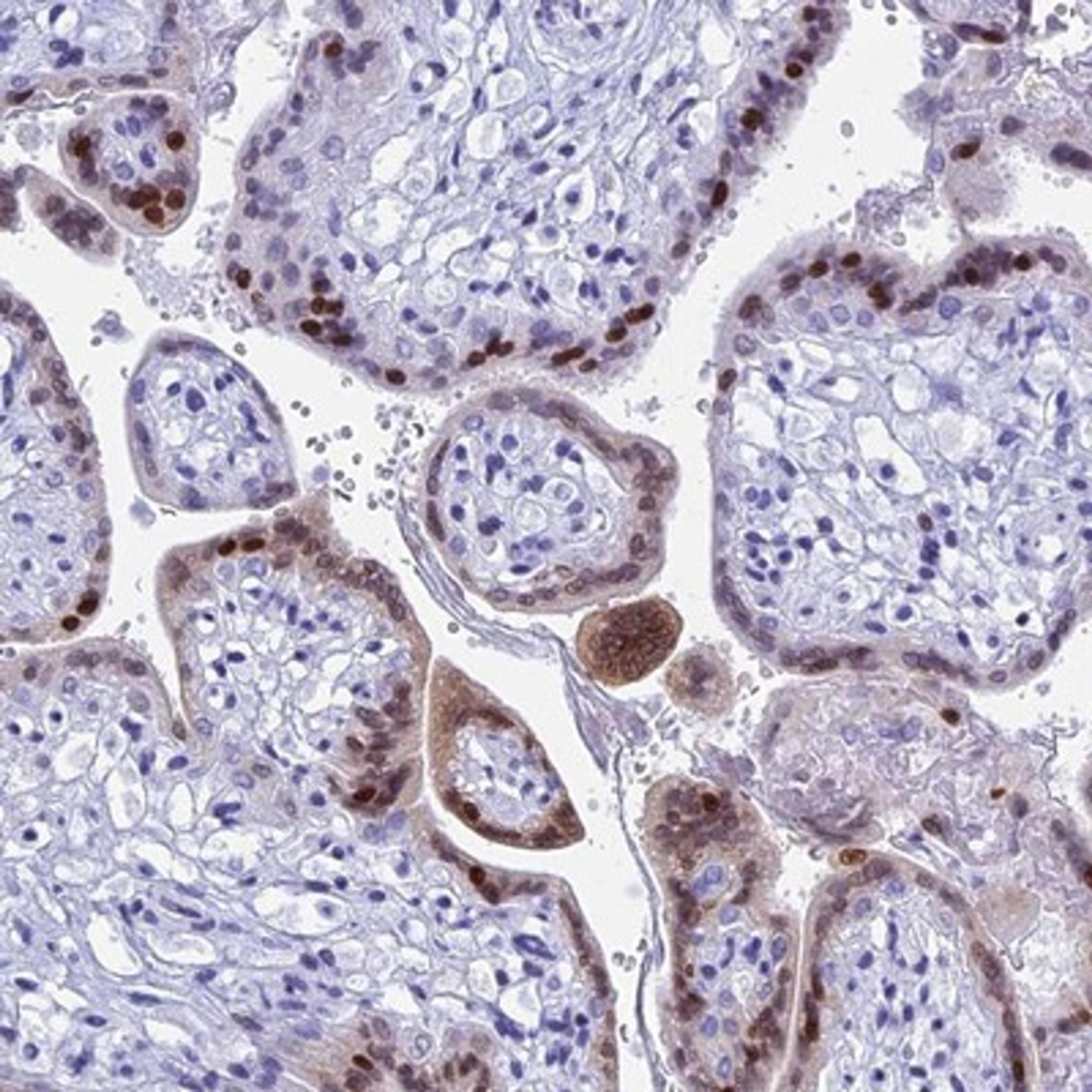 Immunohistochemistry-Paraffin: KCTD21 Antibody [NBP1-81563] - Staining of human placenta shows strong nuclear positivity in subset of trophoblastic cells.