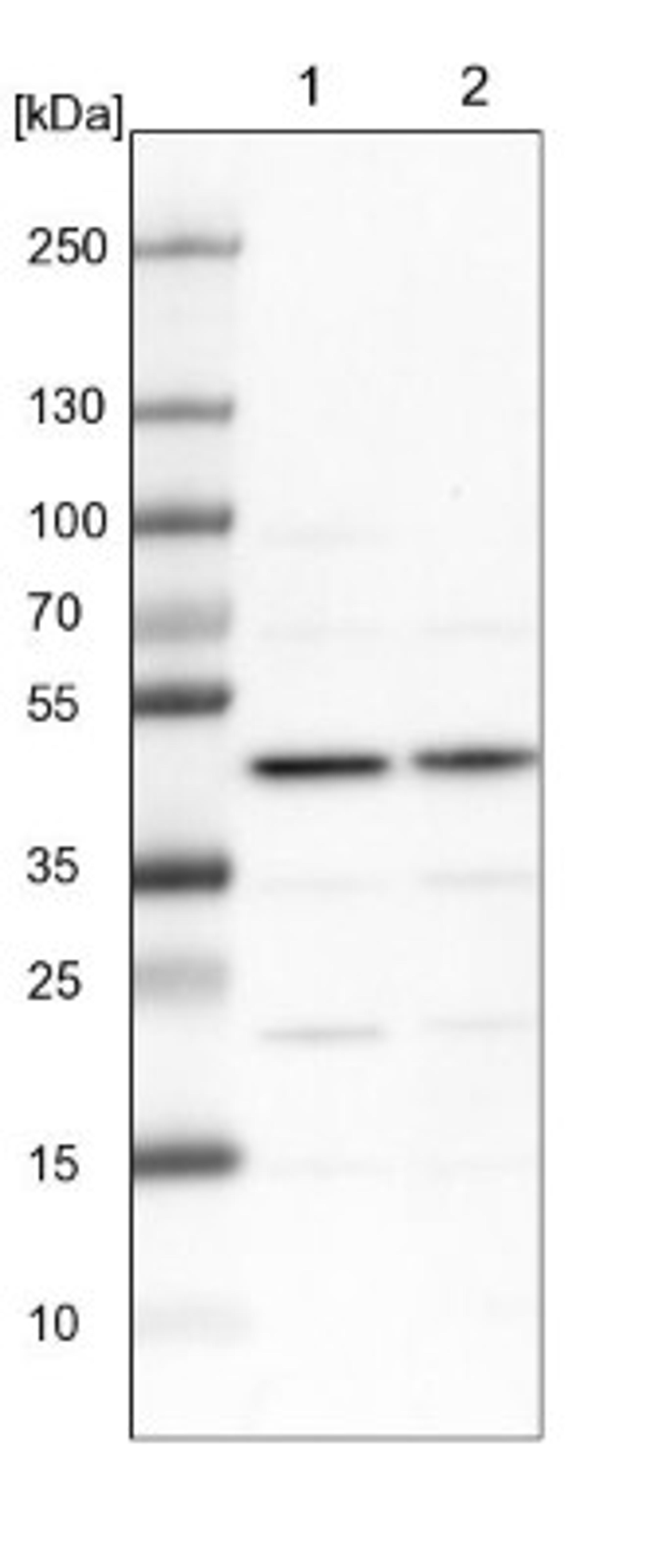 Western Blot: NUPL1 Antibody [NBP2-13684] - Lane 1: NIH-3T3 cell lysate (Mouse embryonic fibroblast cells)<br/>Lane 2: NBT-II cell lysate (Rat Wistar bladder tumour cells)