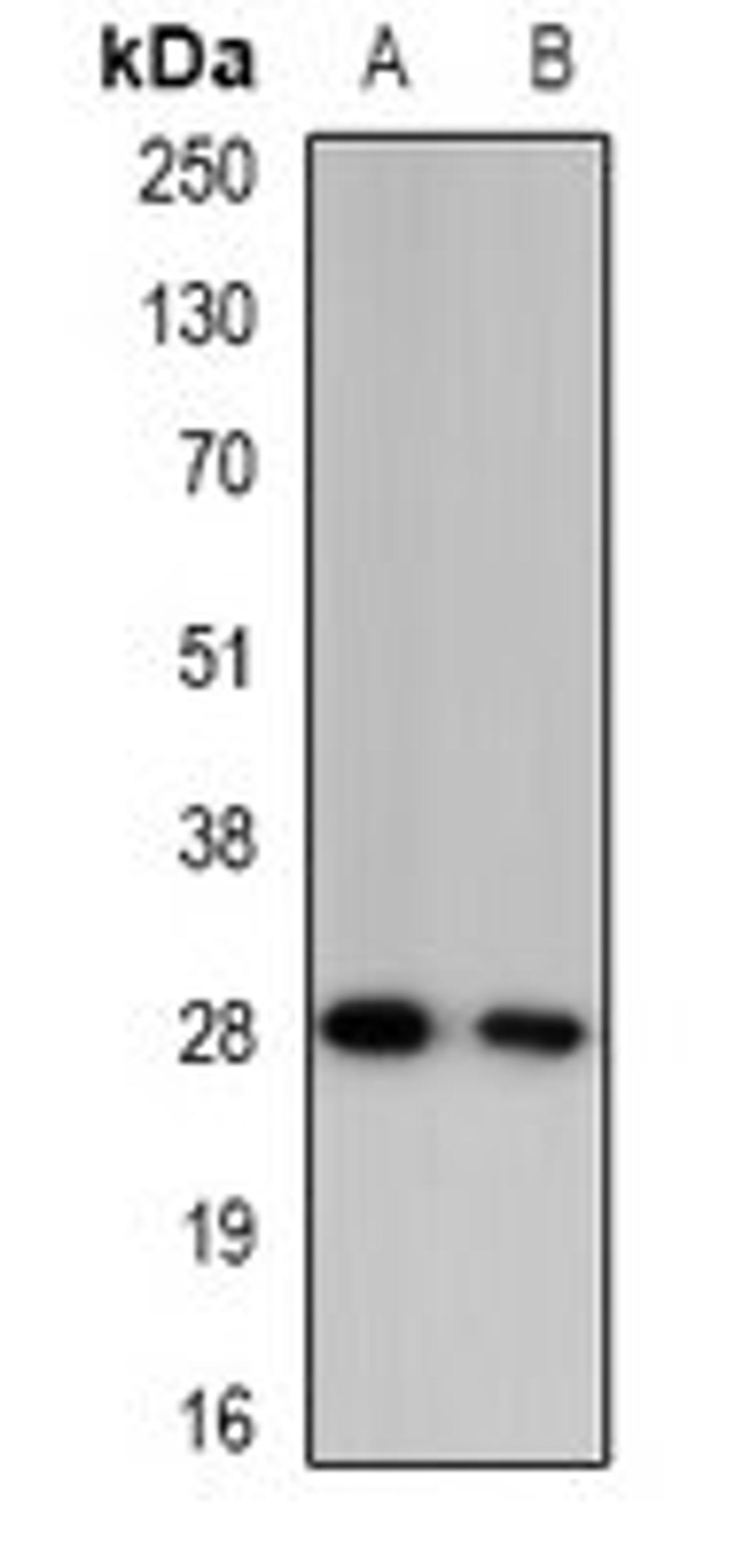 Western blot analysis of mouse blood (Lane1), rat blood (Lane2) whole cell lysates using GZMA antibody