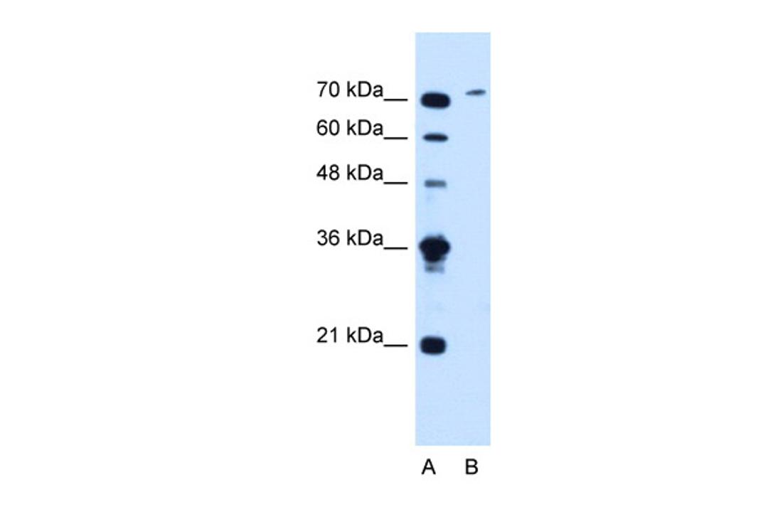 Antibody used in WB on Human Jurkat 1.25 ug/ml.