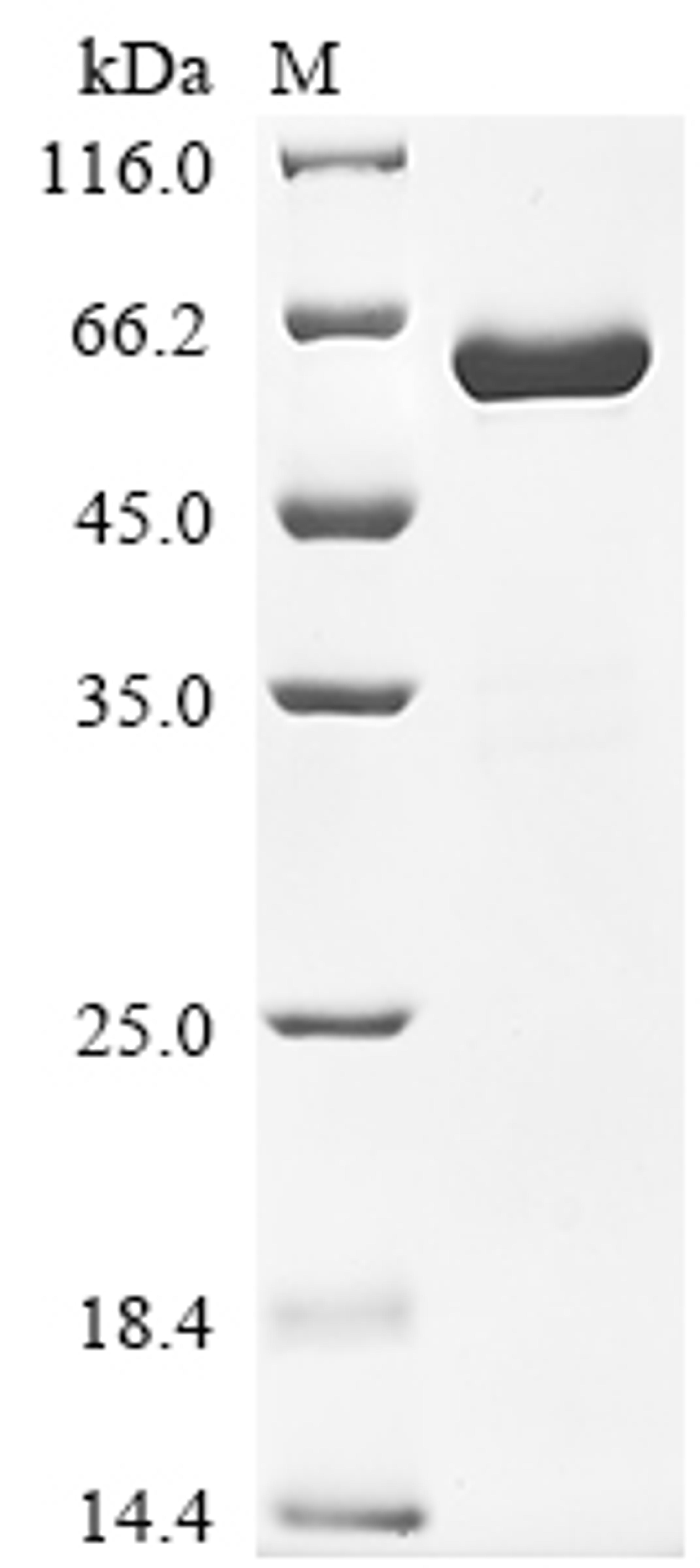(Tris-Glycine gel) Discontinuous SDS-PAGE (reduced) with 5% enrichment gel and 15% separation gel.