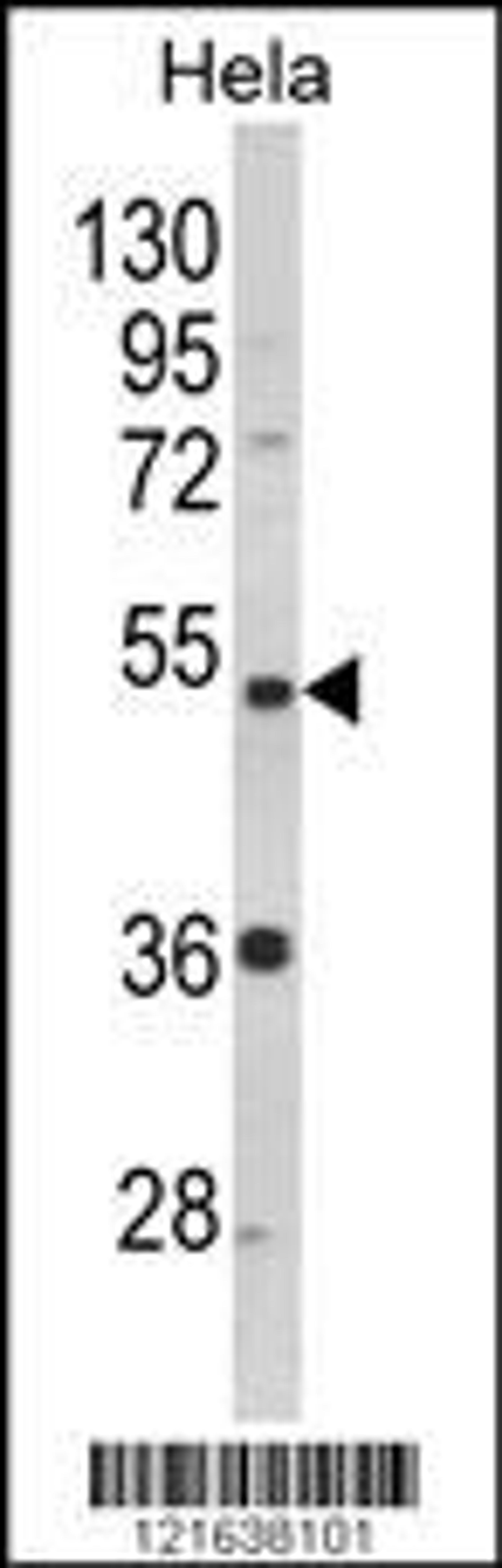 Western blot analysis of PPP2R2B Antibody in Hela cell line lysates (35ug/lane)