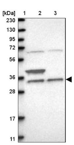 Western Blot: ZFAND1 Antibody [NBP1-82242] - Lane 1: Marker [kDa] 230, 130, 95, 72, 56, 36, 28, 17, 11<br/>Lane 2: Human cell line RT-4<br/>Lane 3: Human cell line U-251MG sp