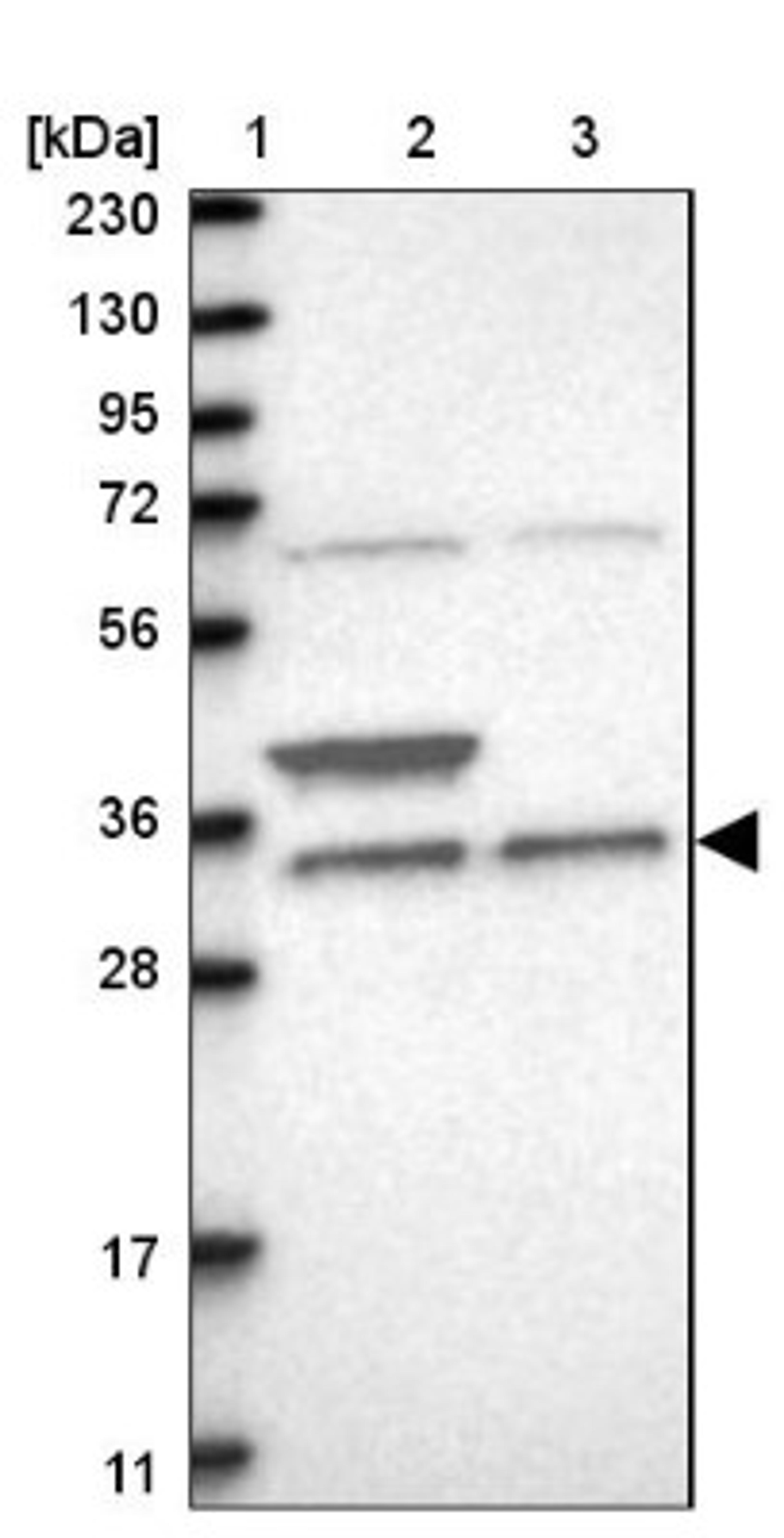 Western Blot: ZFAND1 Antibody [NBP1-82242] - Lane 1: Marker [kDa] 230, 130, 95, 72, 56, 36, 28, 17, 11<br/>Lane 2: Human cell line RT-4<br/>Lane 3: Human cell line U-251MG sp