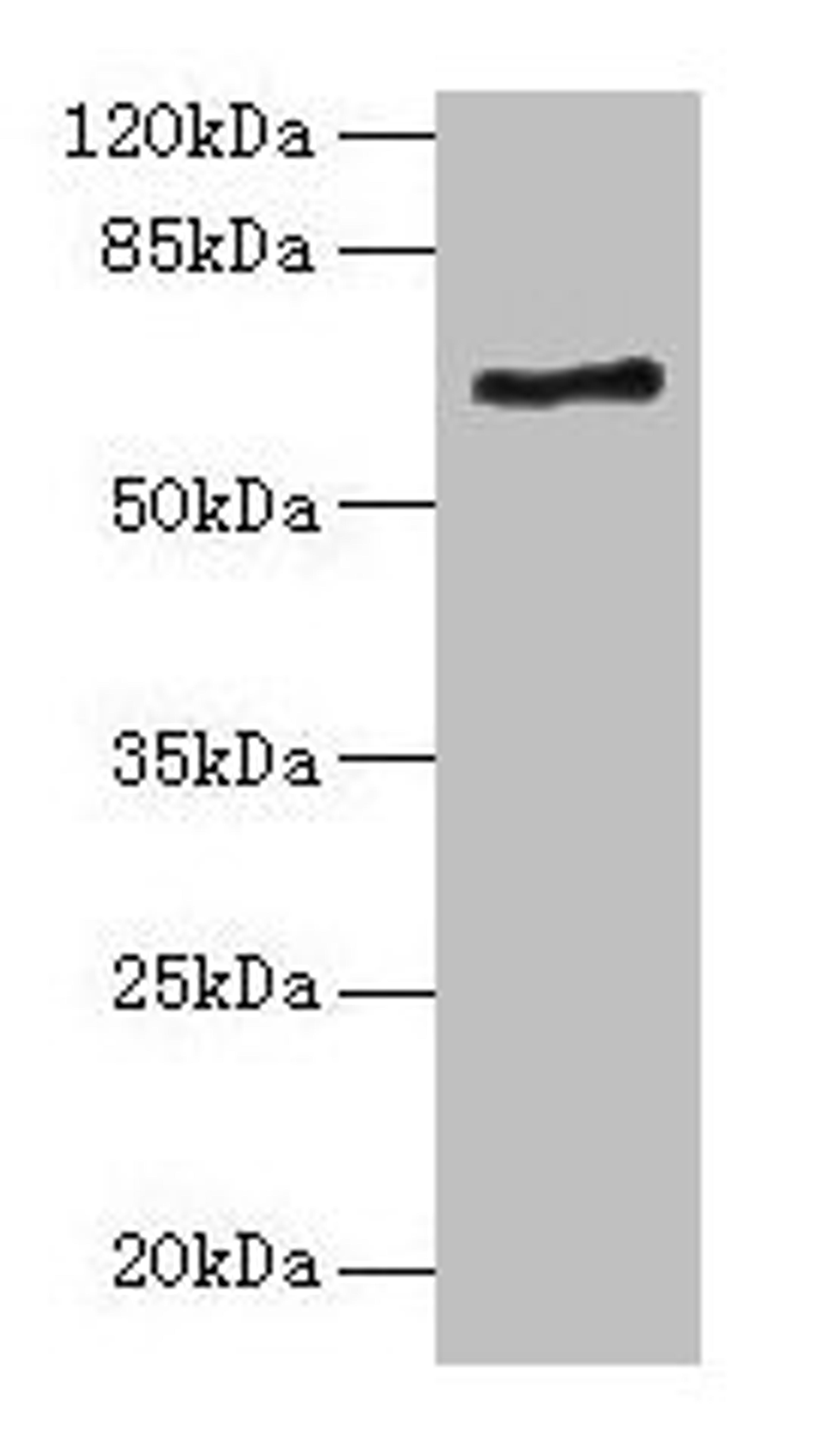 Western blot. All lanes: ALAS2 antibody at 6µg/ml + K562 whole cell lysate. Secondary. Goat polyclonal to rabbit IgG at 1/10000 dilution. Predicted band size: 65, 61, 50, 64 kDa. Observed band size: 65 kDa