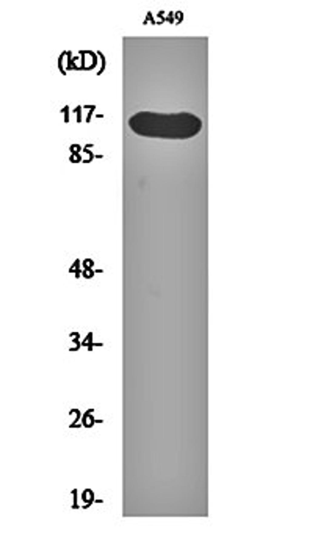 Western blot analysis of A549 cell lysates using Hrs (phospho-Y216) antibody