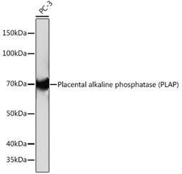 Western blot - Placental alkaline phosphatase (PLAP) Rabbit mAb (A4304)