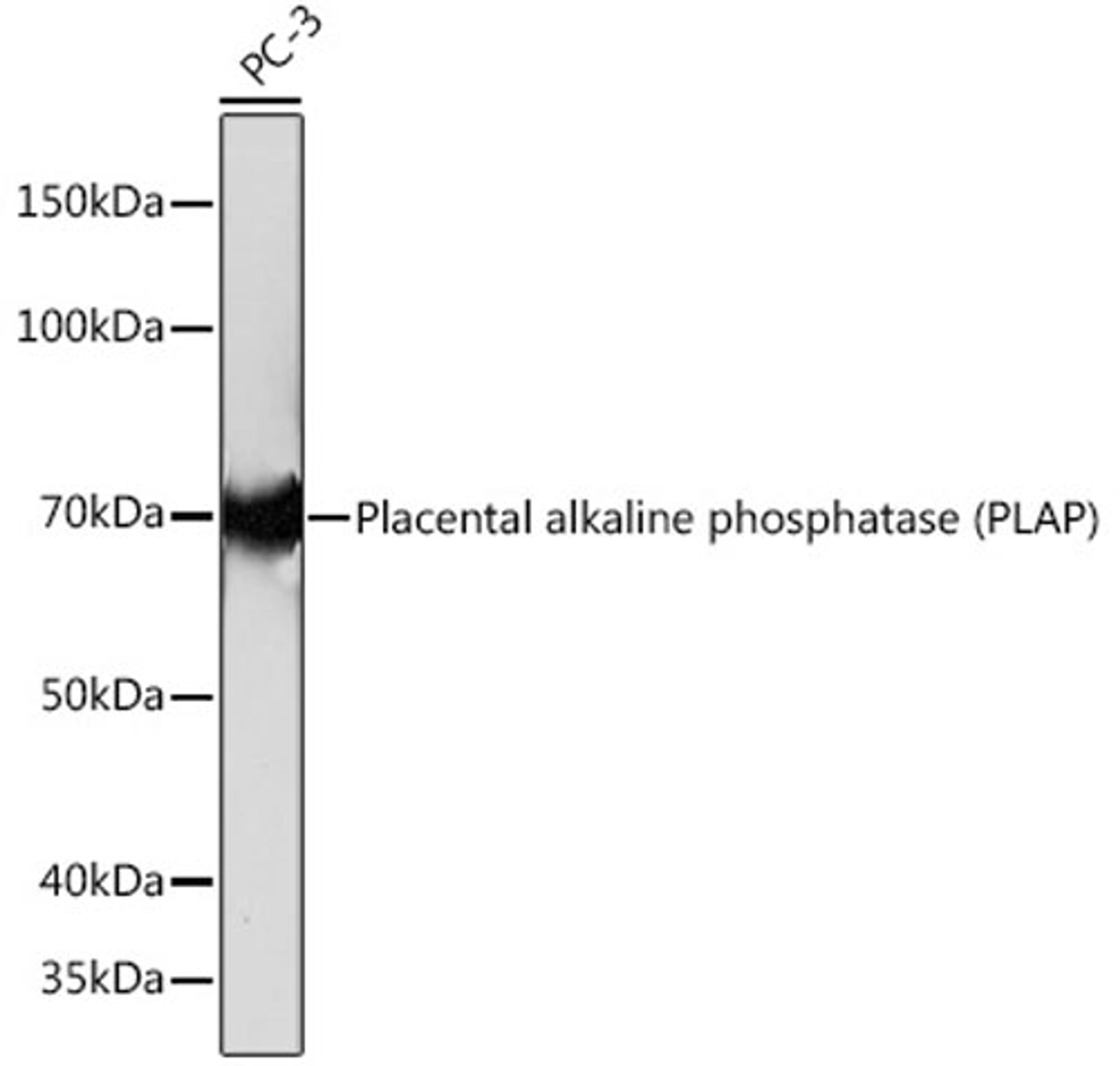 Western blot - Placental alkaline phosphatase (PLAP) Rabbit mAb (A4304)