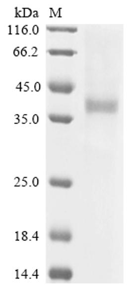 (Tris-Glycine gel) Discontinuous SDS-PAGE (reduced) with 5% enrichment gel and 15% separation gel.