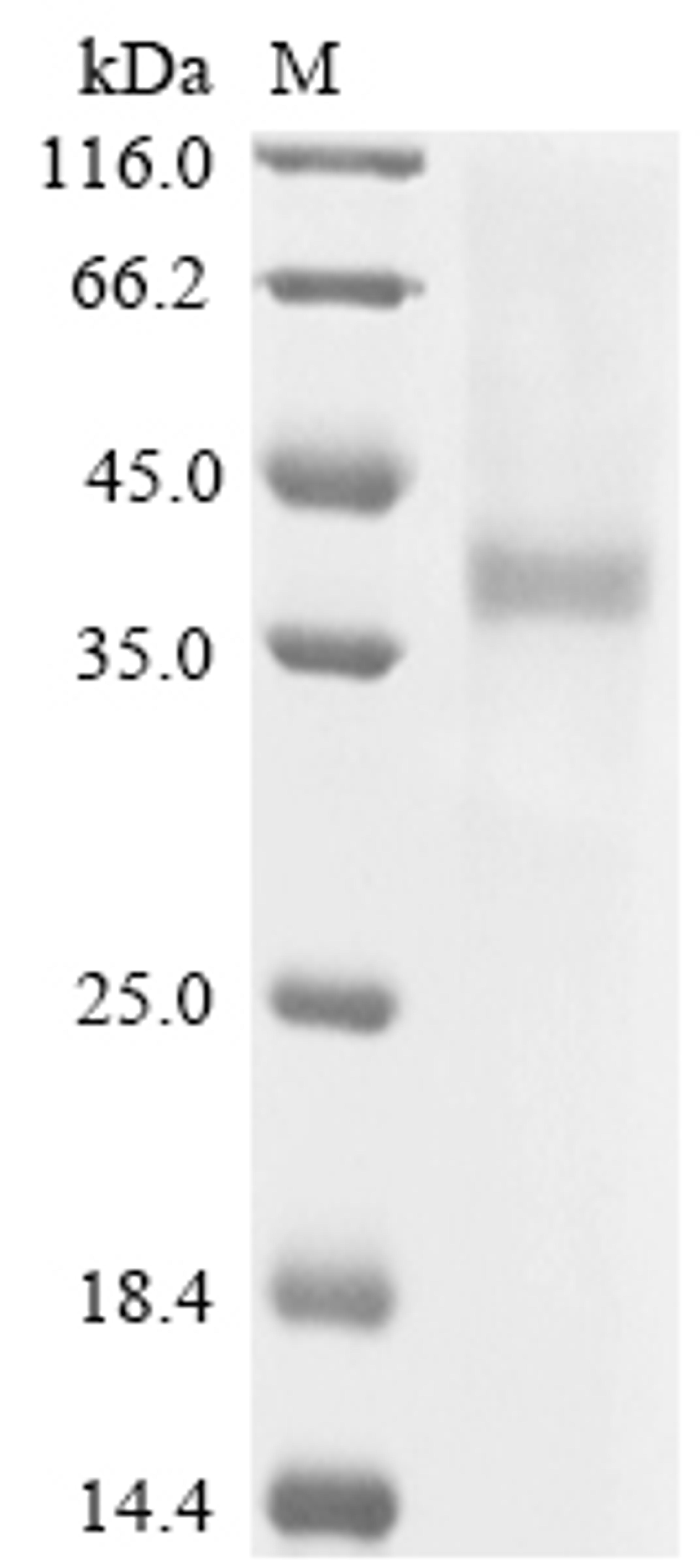 (Tris-Glycine gel) Discontinuous SDS-PAGE (reduced) with 5% enrichment gel and 15% separation gel.