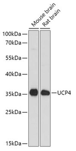 Western blot - SLC25A27 antibody (A13835)