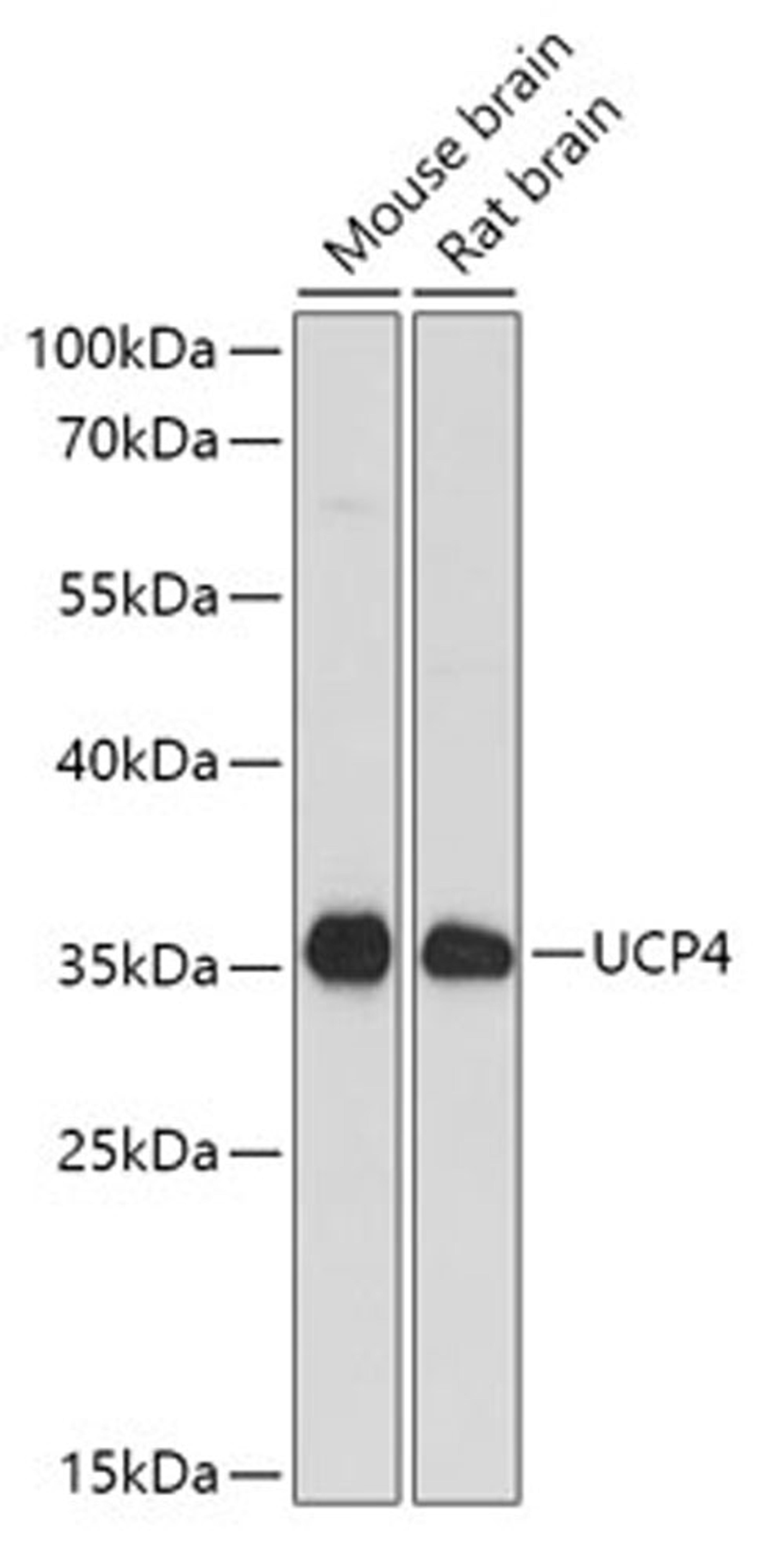 Western blot - SLC25A27 antibody (A13835)