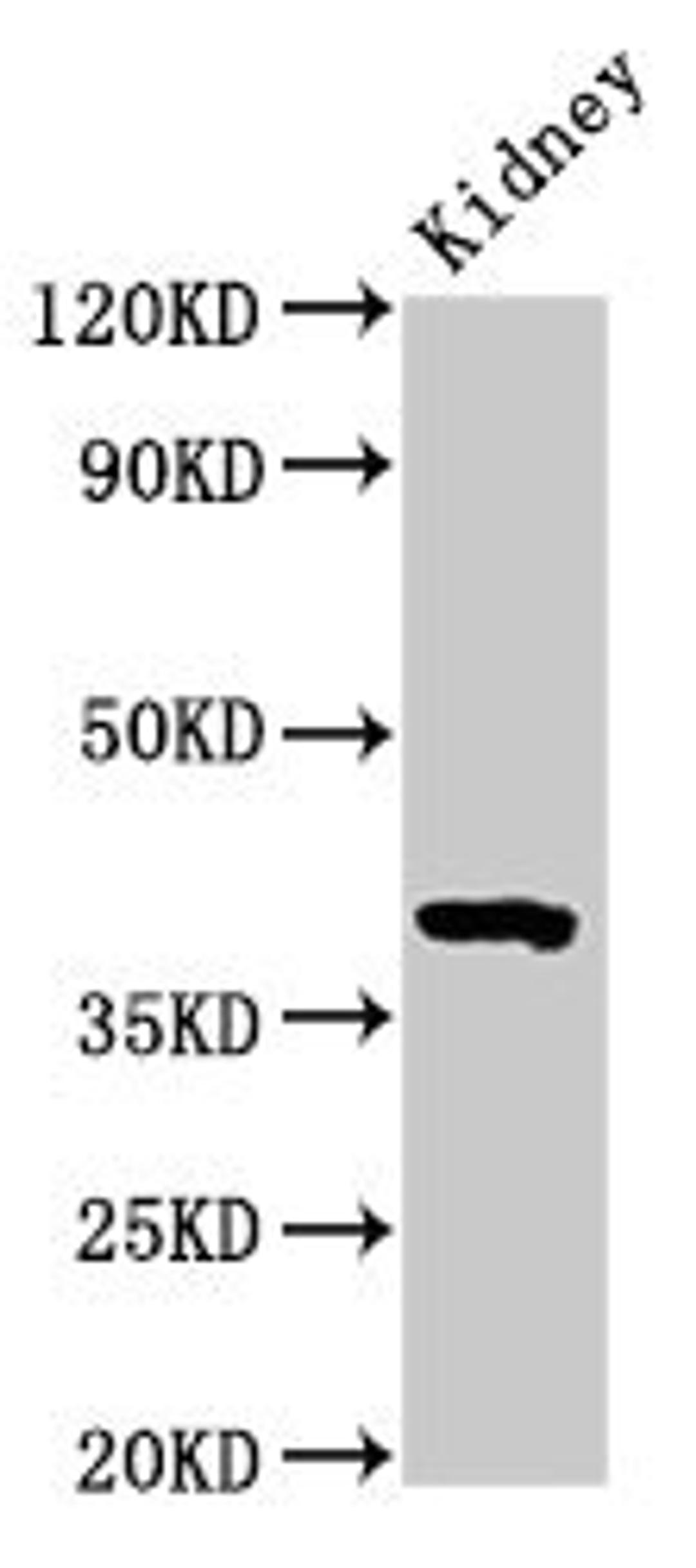 Western Blot. Positive WB detected in: Mouse kidney tissue. All lanes: Wnt3 antibody at 3.2µg/ml. Secondary. Goat polyclonal to rabbit IgG at 1/50000 dilution. Predicted band size: 40 kDa. Observed band size: 40 kDa
