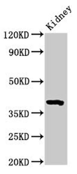 Western Blot. Positive WB detected in: Mouse kidney tissue. All lanes: Wnt3 antibody at 3.2µg/ml. Secondary. Goat polyclonal to rabbit IgG at 1/50000 dilution. Predicted band size: 40 kDa. Observed band size: 40 kDa