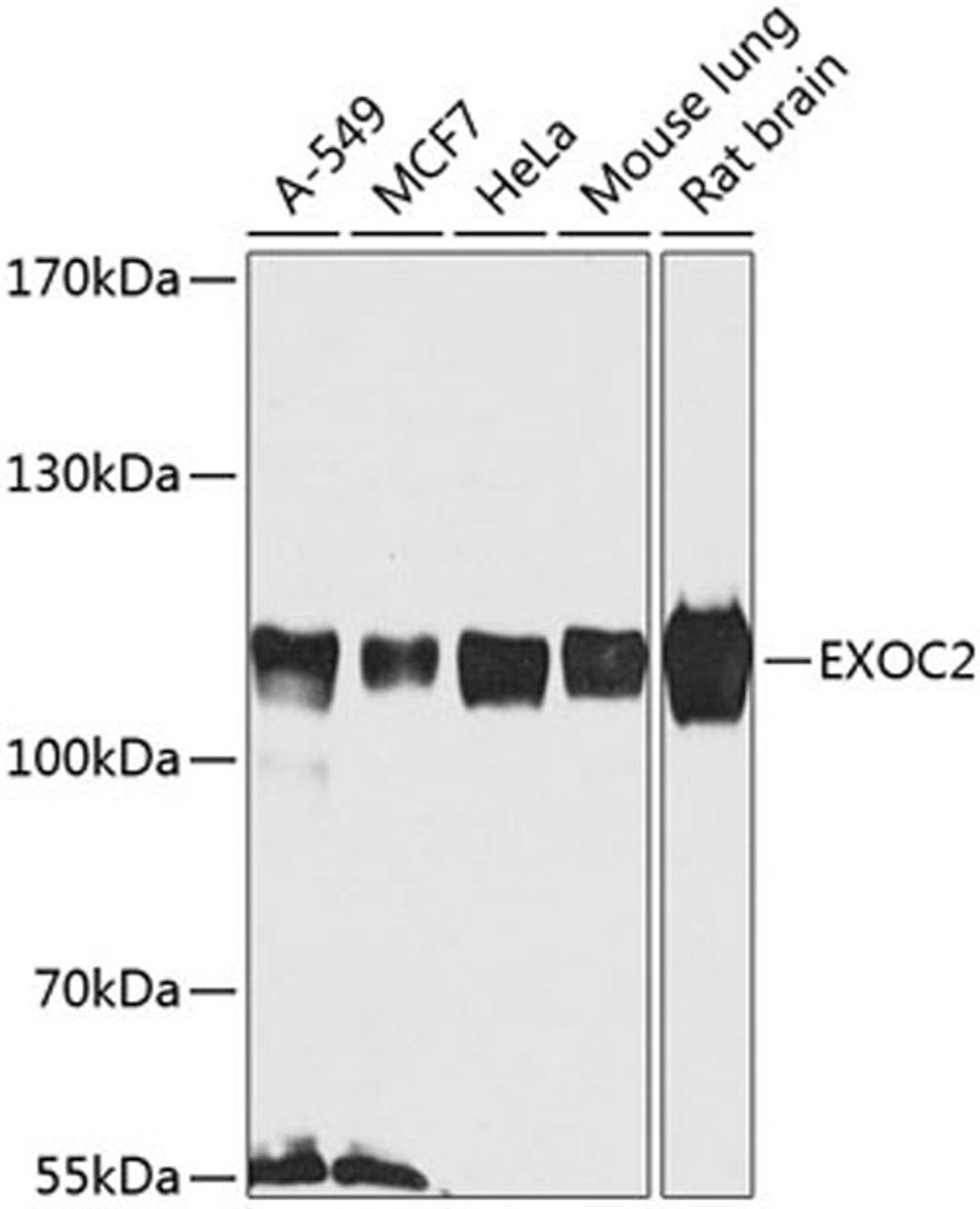 Western blot - EXOC2 antibody (A8235)