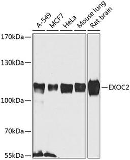 Western blot - EXOC2 antibody (A8235)