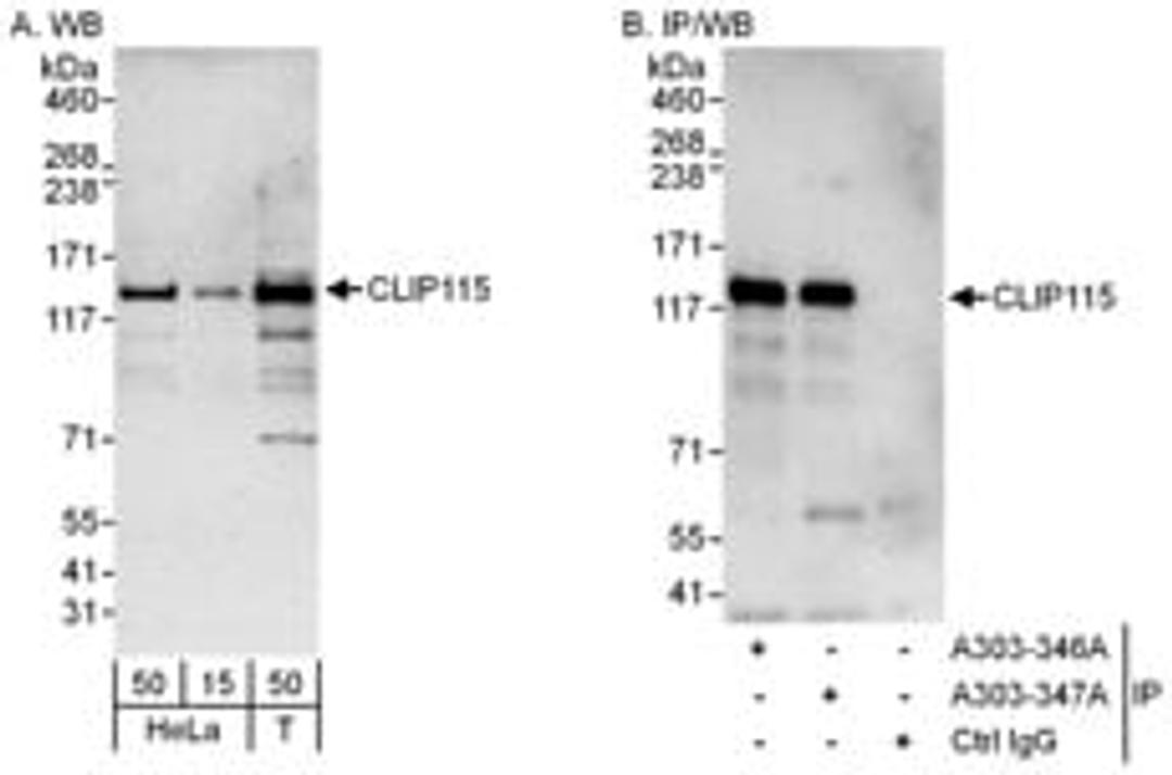 Detection of human CLIP115 by western blot and immunoprecipitation.