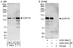 Detection of human CLIP115 by western blot and immunoprecipitation.